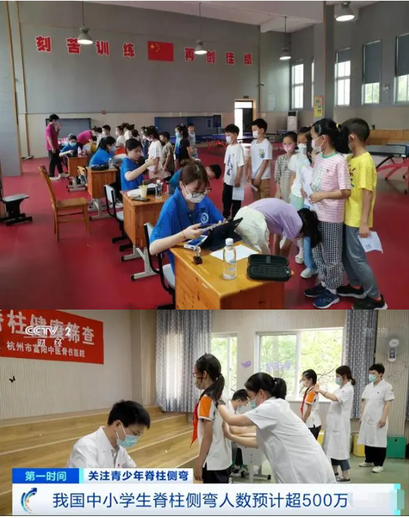 學(xué)校開展脊柱側(cè)彎?rùn)z查
