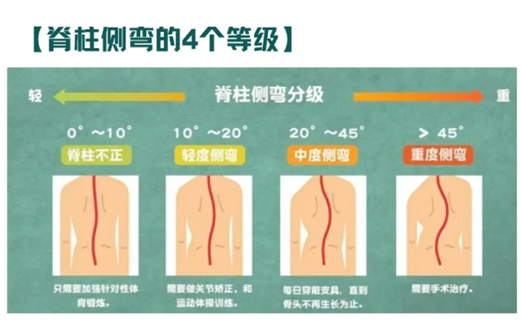 【坐姿一定要糾正??】孩子坐姿是關(guān)鍵，別再耽誤孩子